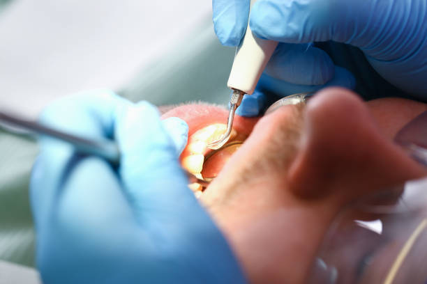 Best Same-Day Emergency Dental Services in Lansdowne, VA