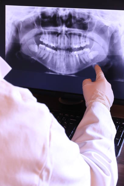 Best Emergency Dental Care for Broken or Chipped Teeth in Lansdowne, VA